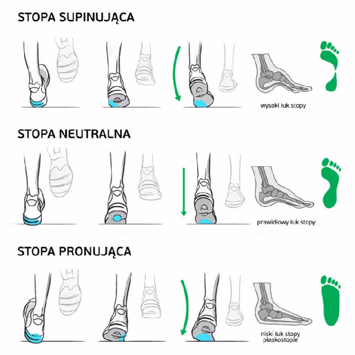 Czy buty pronujące są zdrowe?