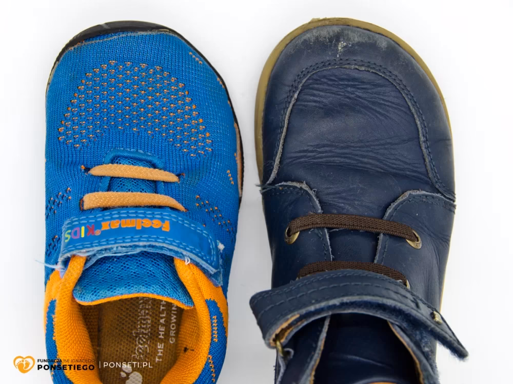 Jakie buty dla dziecka na szeroką stopę?